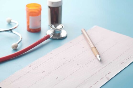 A stethoscope, two prescription pill bottles, a pen, and an EKG printout with labeled leads (V1–V4) are arranged on a light blue surface.